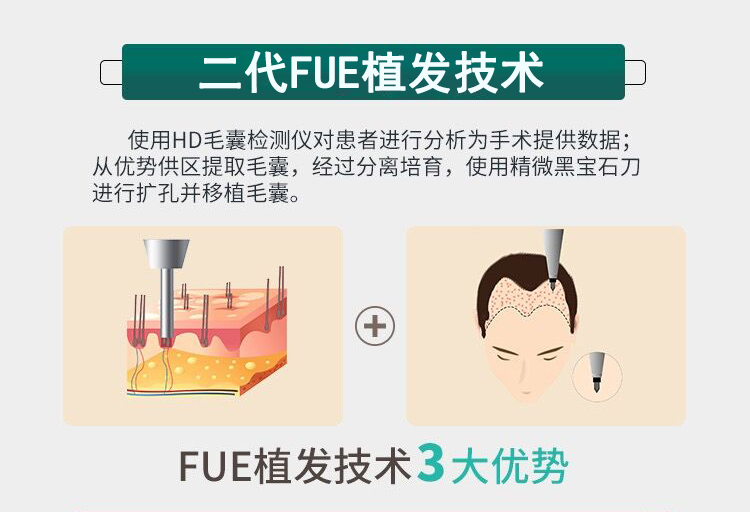 二代FUE植發技術